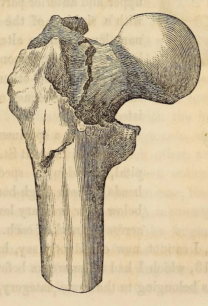 An illustration from The American journal of the medical sciences, 1827, leaf 319