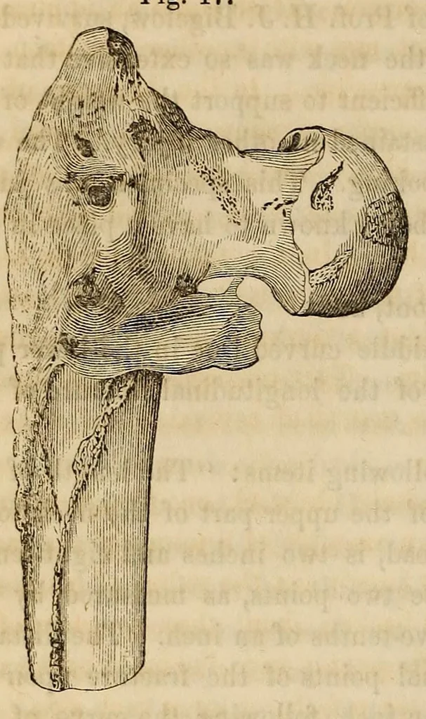 An illustration from The American journal of the medical sciences, 1827, leaf 320