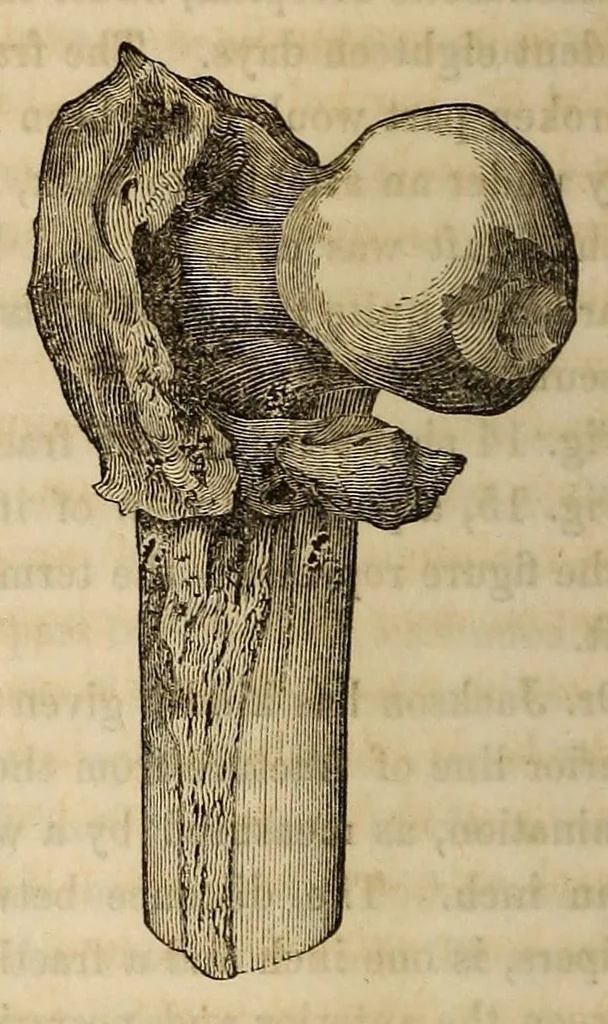 An illustration from The American journal of the medical sciences, 1827, leaf 320