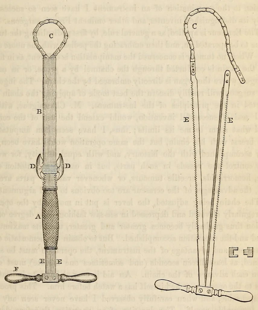 An illustration from The American journal of the medical sciences, 1827, leaf 65