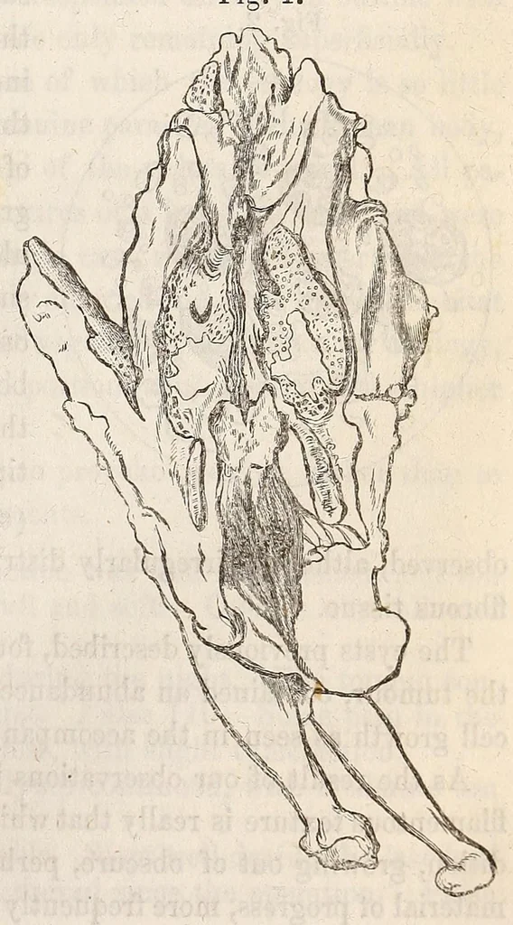 An illustration from The American journal of the medical sciences, 1827, leaf 121