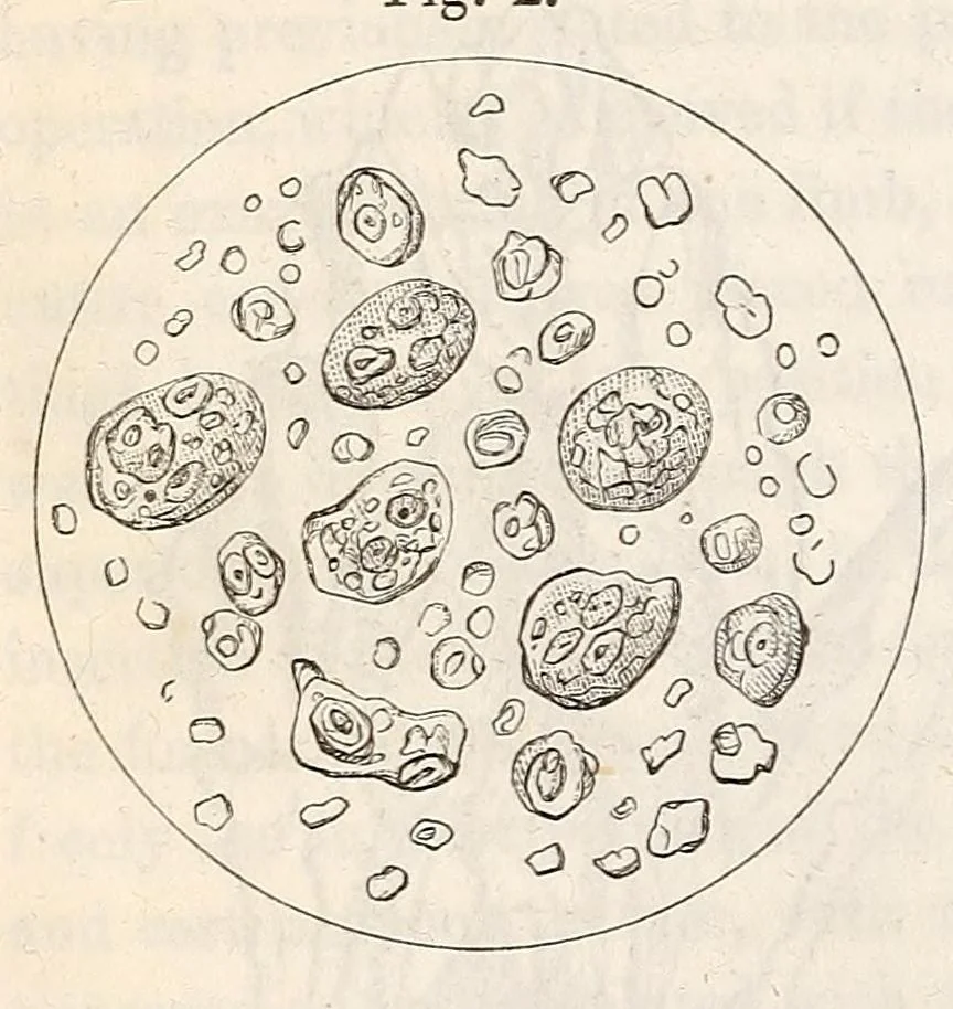 An illustration from The American journal of the medical sciences, 1827, leaf 122