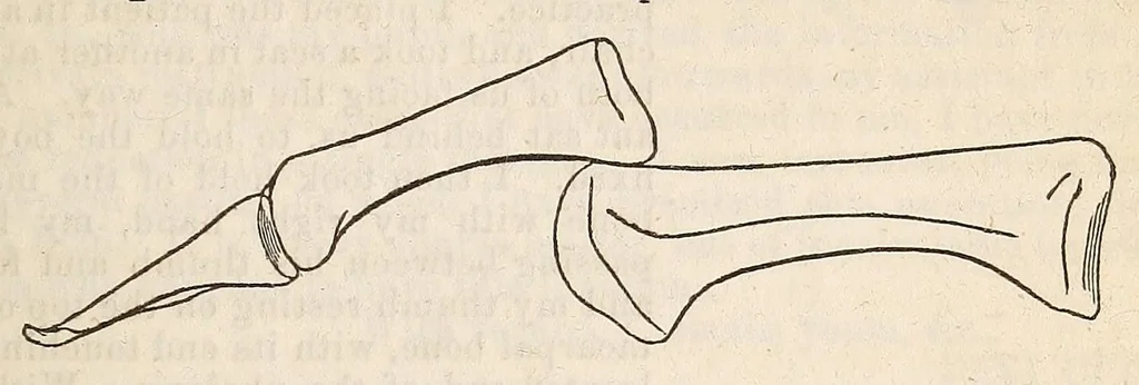 An illustration from The American journal of the medical sciences, 1827, leaf 569