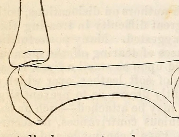 An illustration from The American journal of the medical sciences, 1827, leaf 570