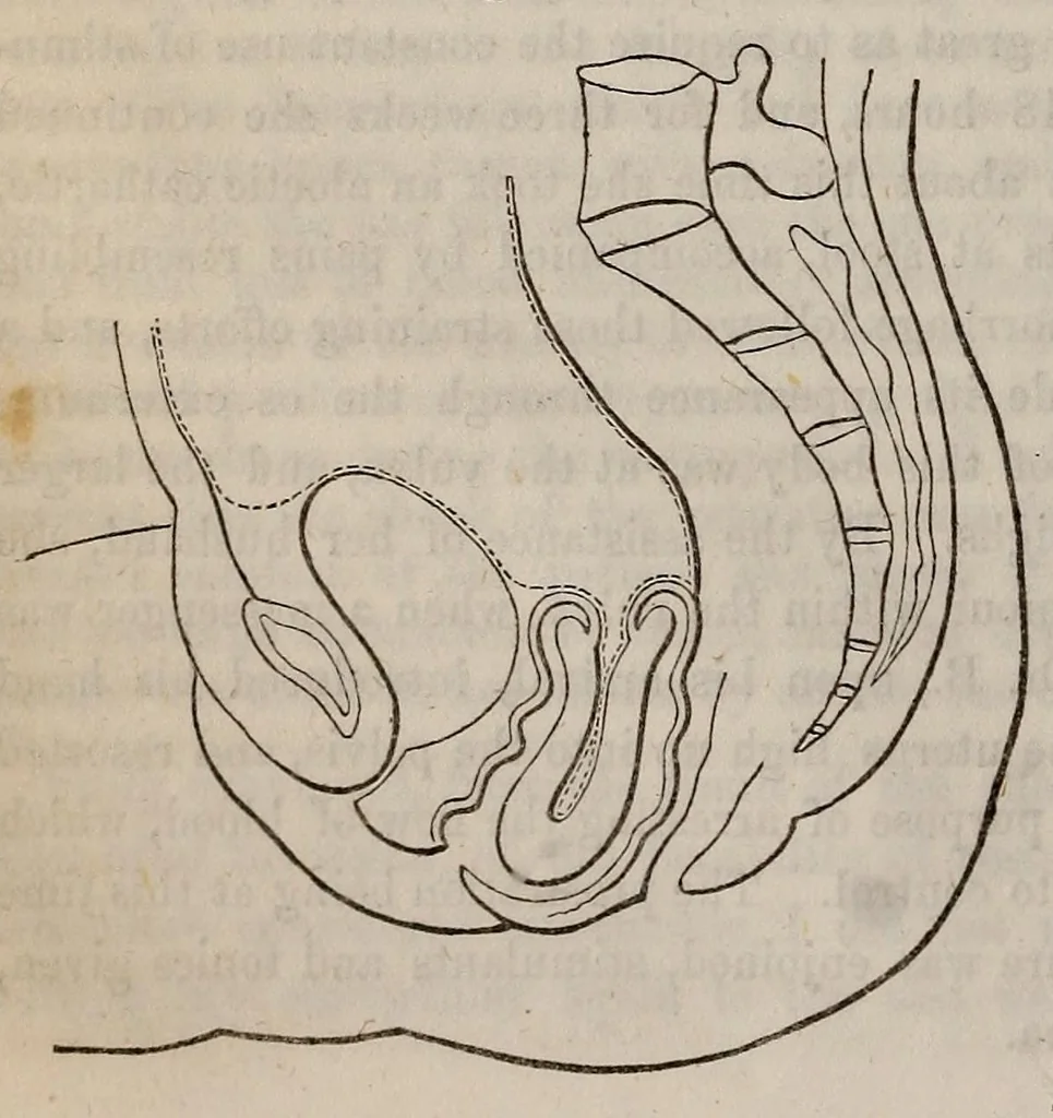 An illustration from The American journal of the medical sciences, 1827, leaf 24