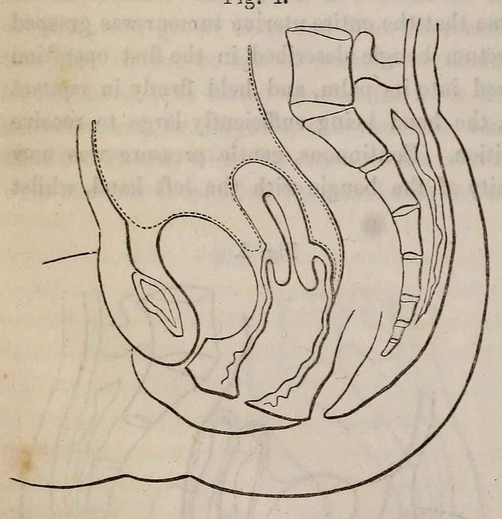 An illustration from The American journal of the medical sciences, 1827, leaf 26