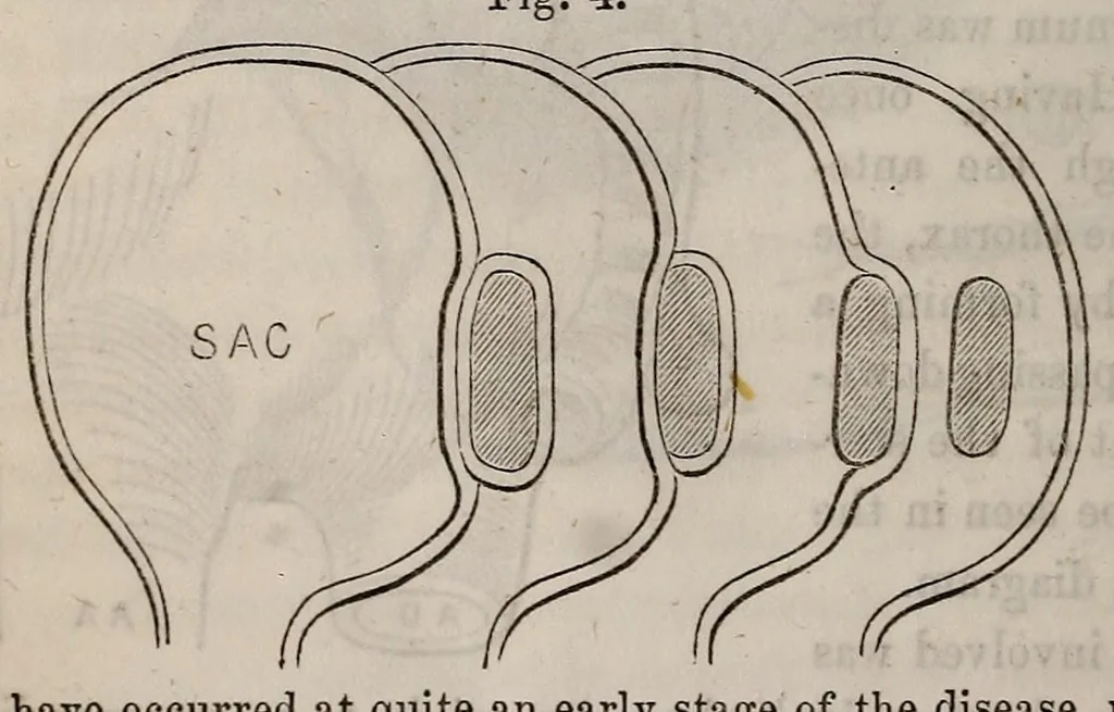 An illustration from The American journal of the medical sciences, 1827, leaf 58