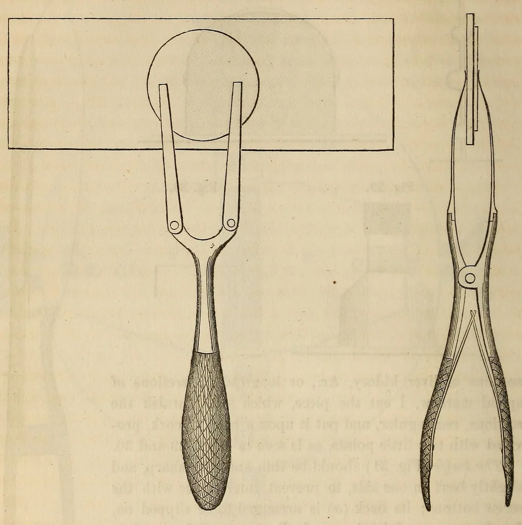 An illustration from The American journal of the medical sciences, 1827, leaf 52