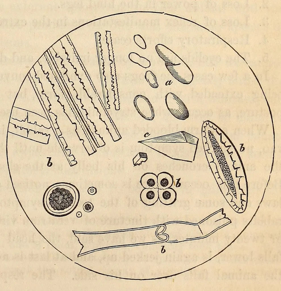 An illustration from The American journal of the medical sciences, 1827, leaf 41
