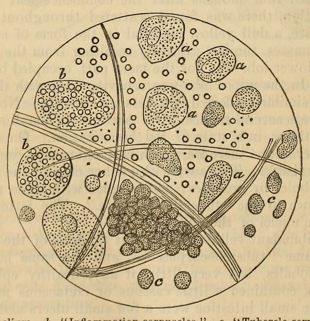 An illustration from The American journal of the medical sciences, 1827, leaf 414