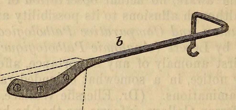 An illustration from The American journal of the medical sciences, 1827, leaf 572