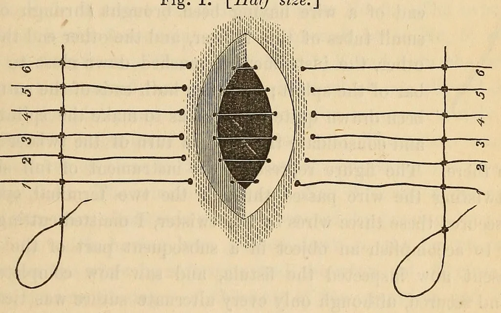 An illustration from The American journal of the medical sciences, 1827, leaf 75