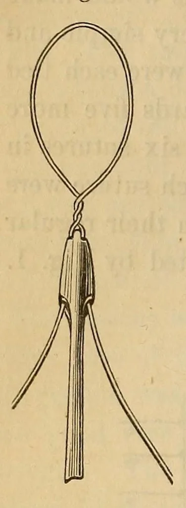 An illustration from The American journal of the medical sciences, 1827, leaf 76