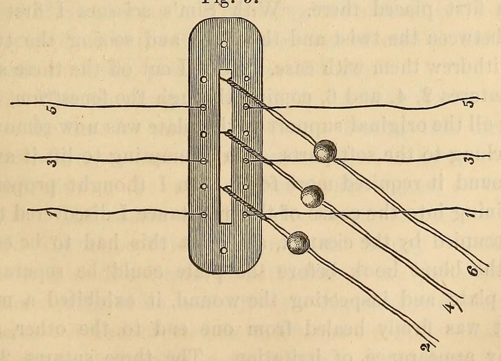 An illustration from The American journal of the medical sciences, 1827, leaf 77