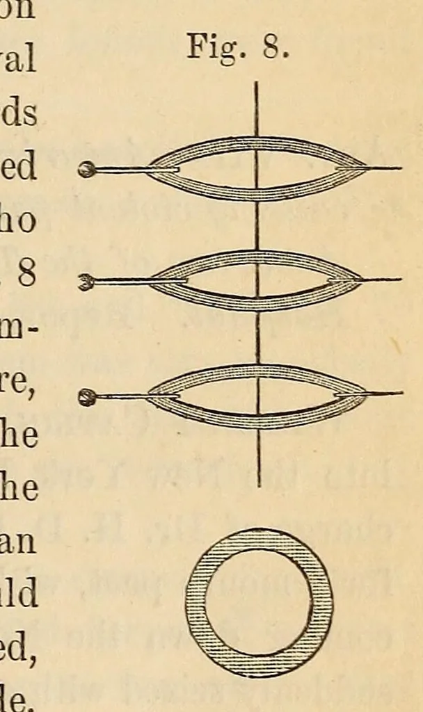 An illustration from The American journal of the medical sciences, 1827, leaf 85