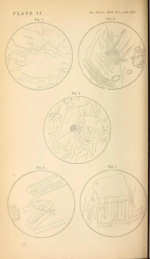 An illustration from The American journal of the medical sciences, 1827, leaf 306