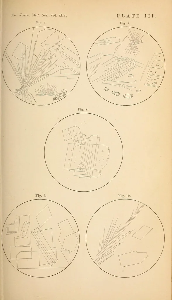 An illustration from The American journal of the medical sciences, 1827, leaf 307