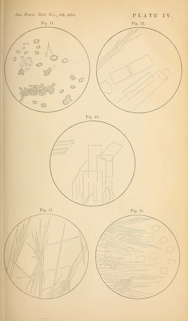 An illustration from The American journal of the medical sciences, 1827, leaf 309