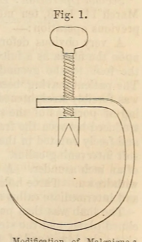 An illustration from The American journal of the medical sciences, 1827, leaf 315