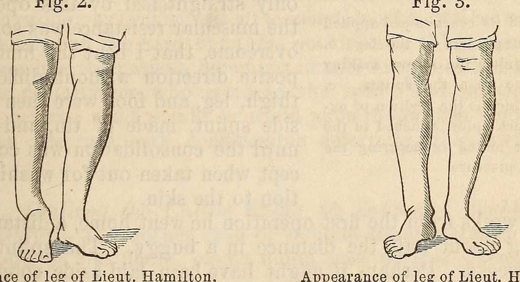 An illustration from The American journal of the medical sciences, 1827, leaf 317