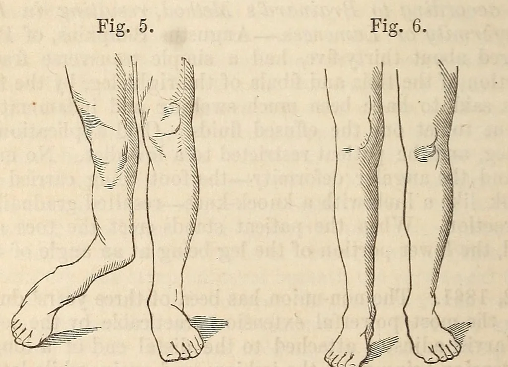 An illustration from The American journal of the medical sciences, 1827, leaf 318