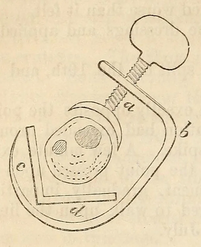 An illustration from The American journal of the medical sciences, 1827, leaf 318