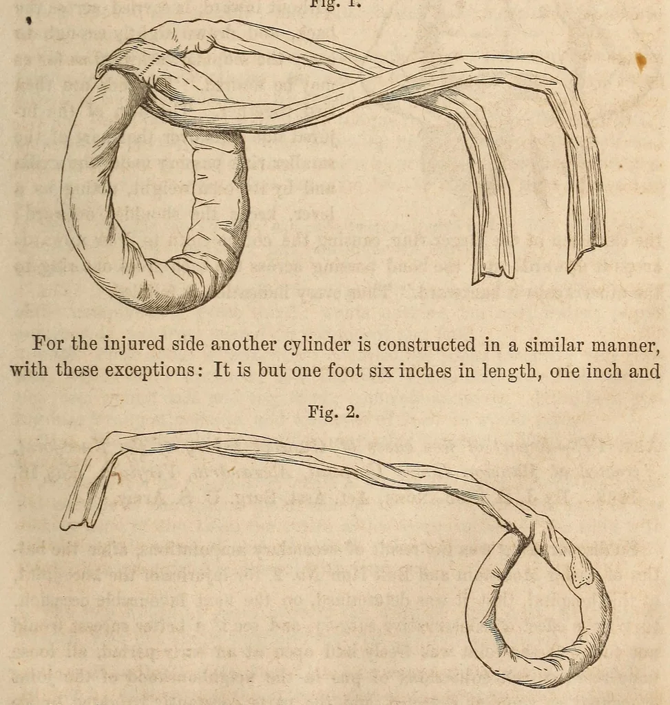 An illustration from The American journal of the medical sciences, 1827, leaf 43