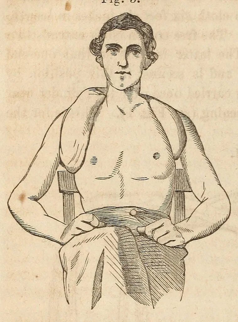 An illustration from The American journal of the medical sciences, 1827, leaf 44