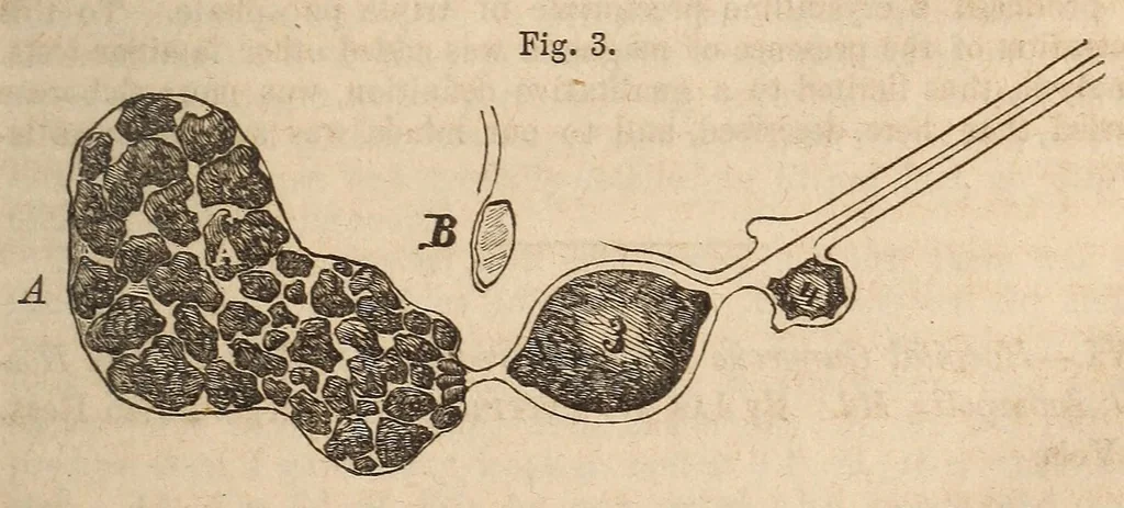 An illustration from The American journal of the medical sciences, 1827, leaf 51