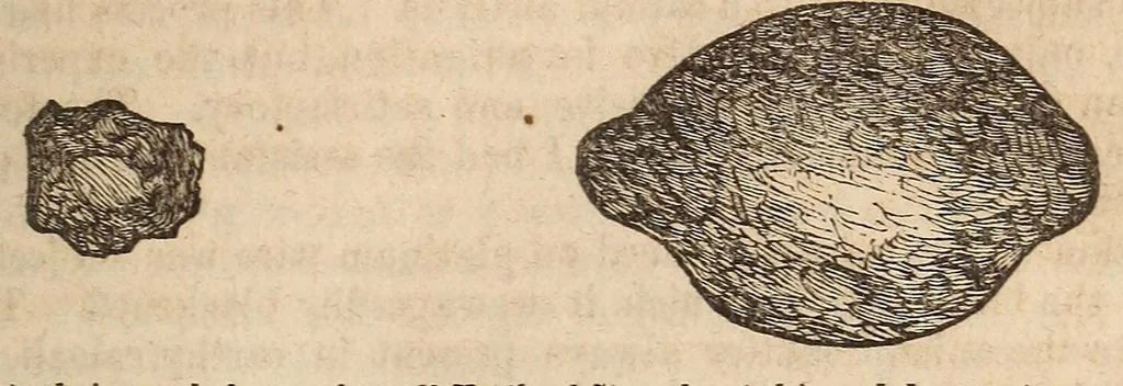 An illustration from The American journal of the medical sciences, 1827, leaf 51