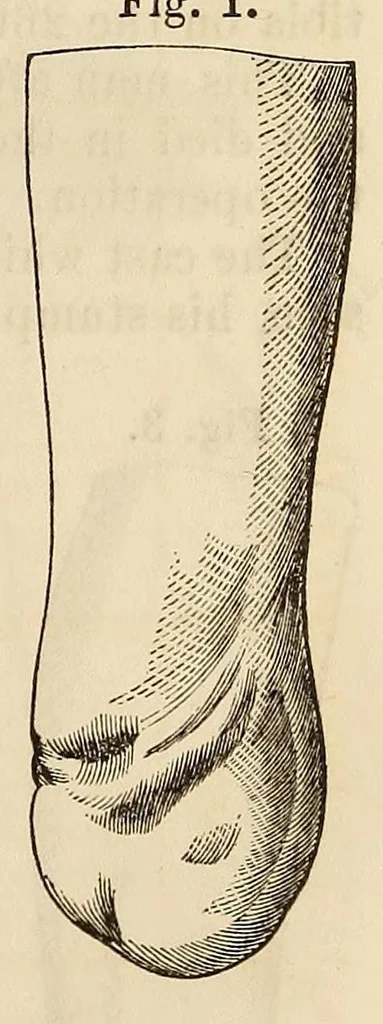 An illustration from The American journal of the medical sciences, 1827, leaf 123