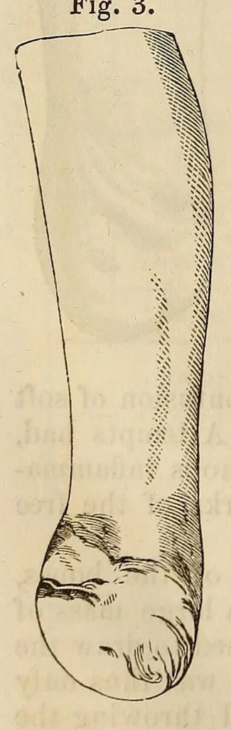 An illustration from The American journal of the medical sciences, 1827, leaf 124