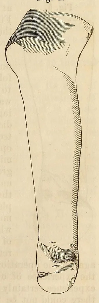 An illustration from The American journal of the medical sciences, 1827, leaf 125