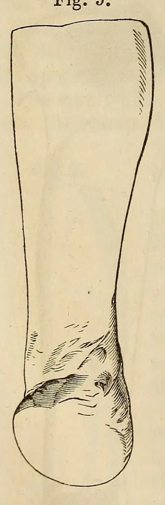 An illustration from The American journal of the medical sciences, 1827, leaf 126