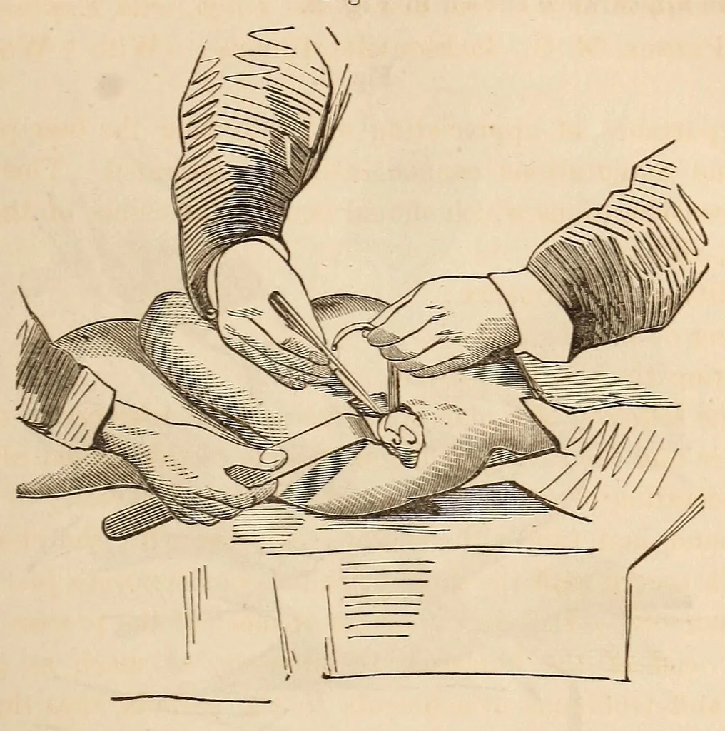 An illustration from The American journal of the medical sciences, 1827, leaf 305