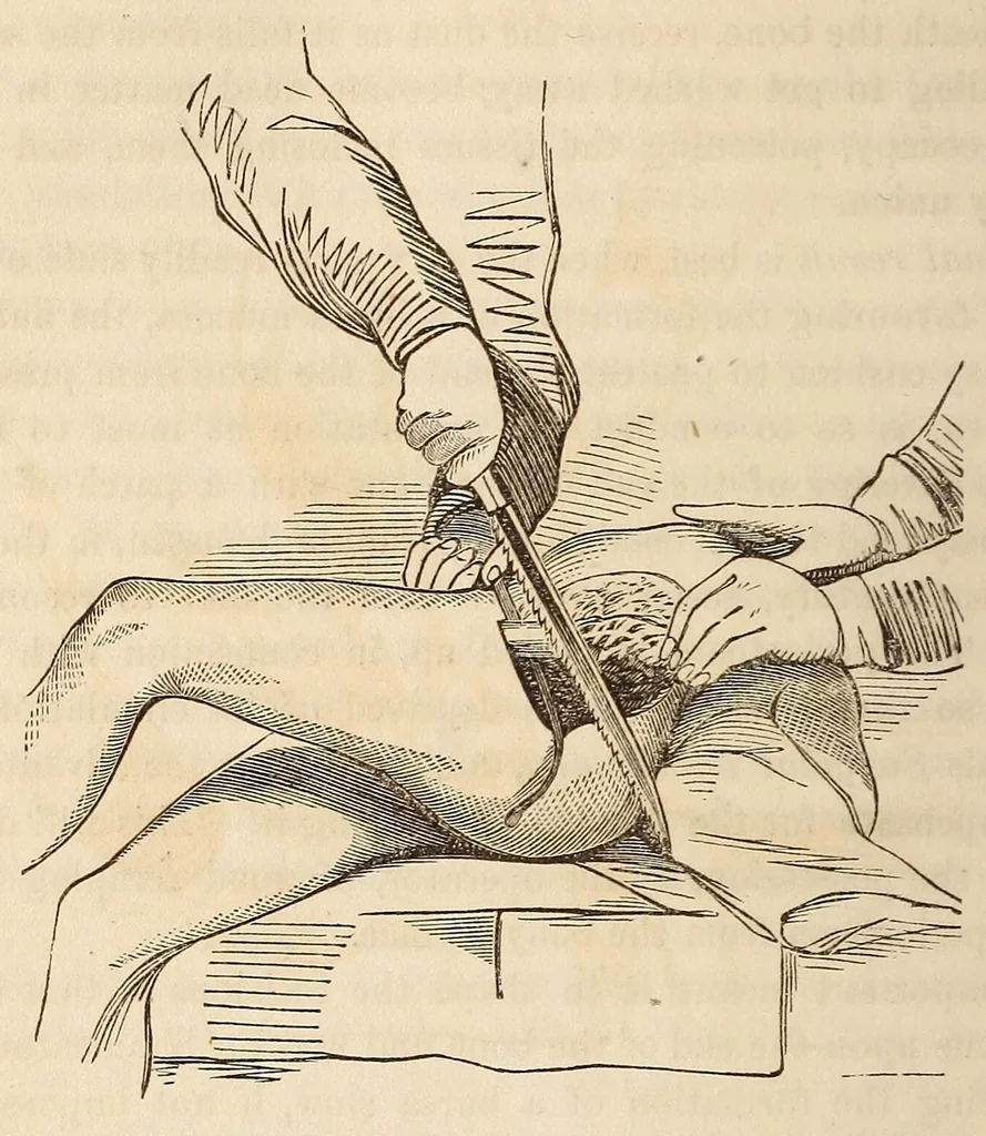 An illustration from The American journal of the medical sciences, 1827, leaf 314