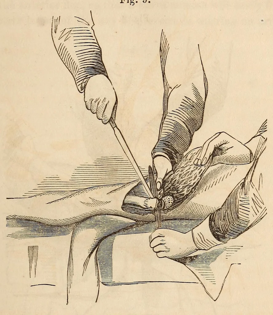 An illustration from The American journal of the medical sciences, 1827, leaf 315