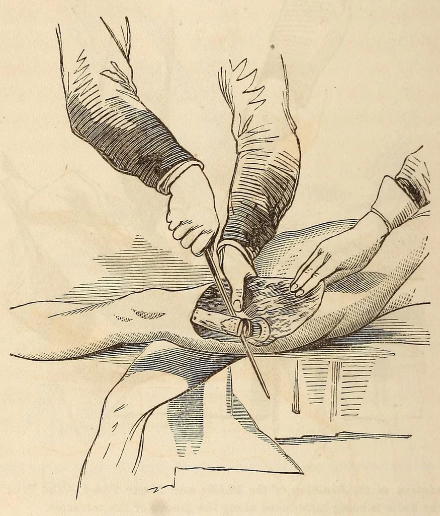 An illustration from The American journal of the medical sciences, 1827, leaf 316