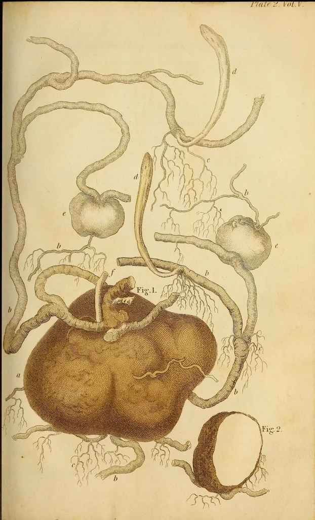 An illustration from The American journal of the medical sciences, 1827, leaf 321