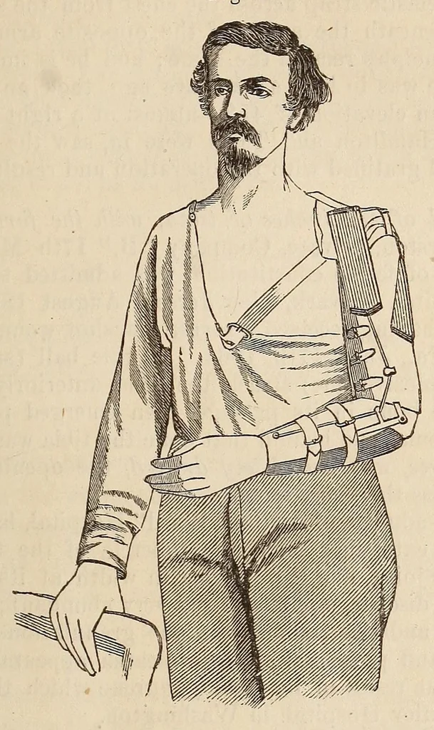 An illustration from The American journal of the medical sciences, 1827, leaf 145