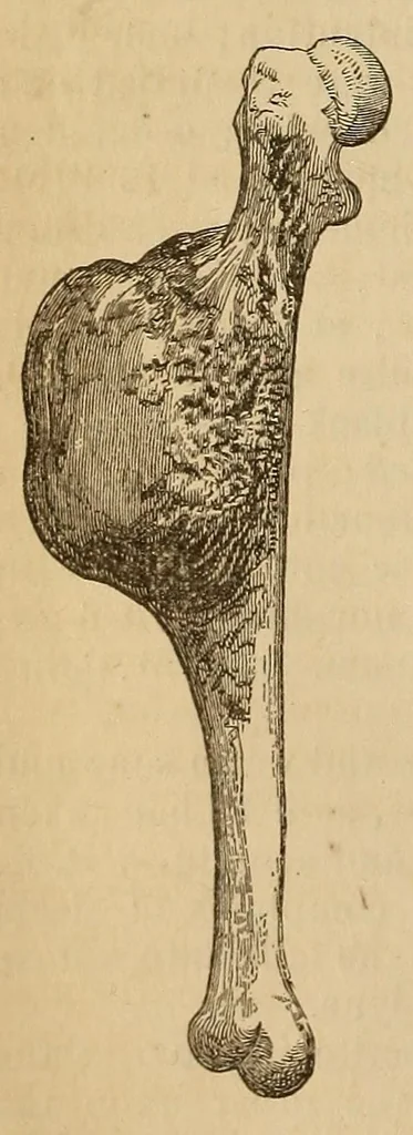 An illustration from The American journal of the medical sciences, 1827, leaf 28