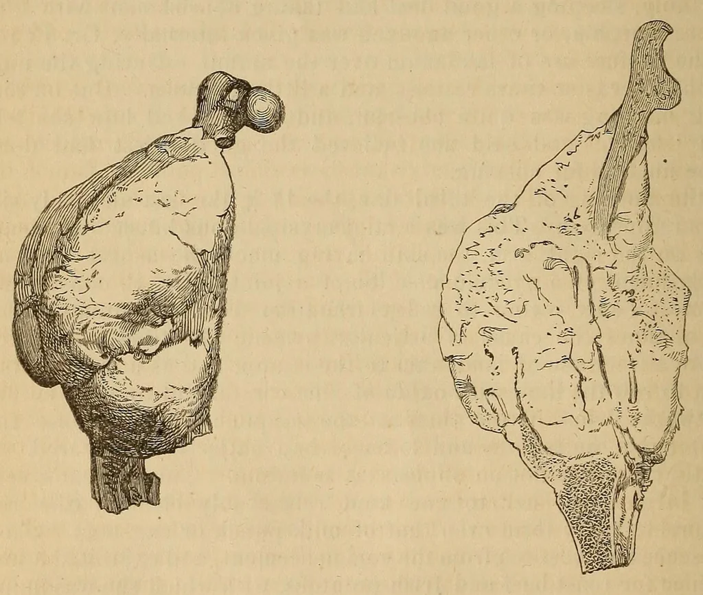 An illustration from The American journal of the medical sciences, 1827, leaf 32