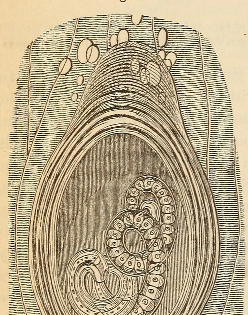 An illustration from The American journal of the medical sciences, 1827, leaf 100