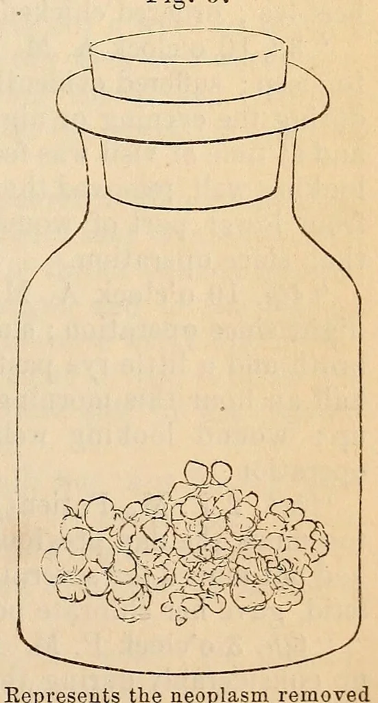 An illustration from The American journal of the medical sciences, 1827, leaf 147