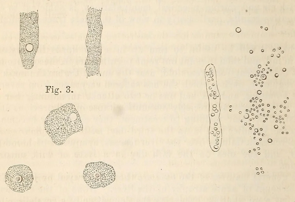 An illustration from The American journal of the medical sciences, 1827, leaf 422