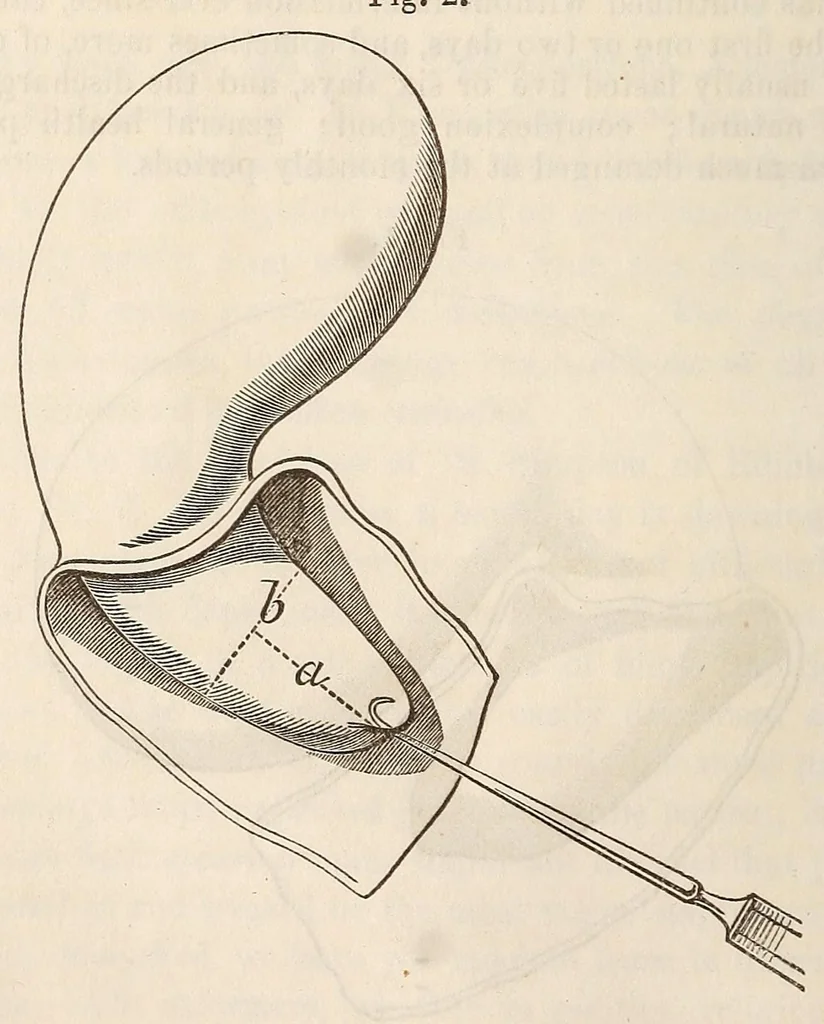 An illustration from The American journal of the medical sciences, 1827, leaf 106