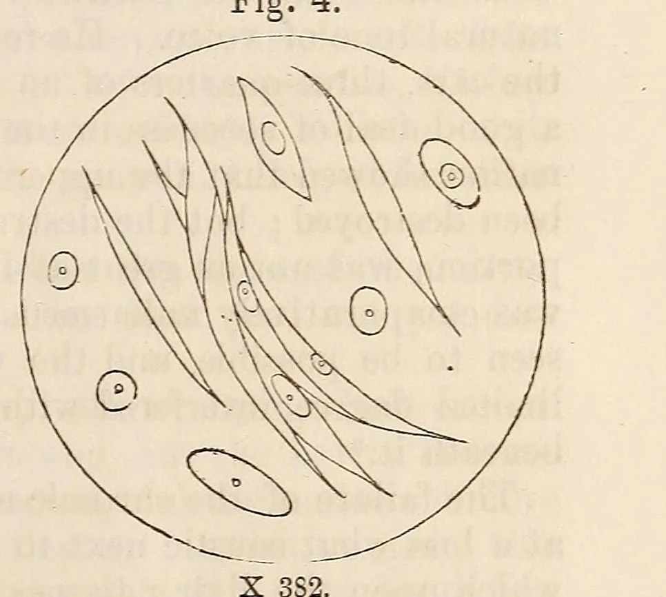 An illustration from The American journal of the medical sciences, 1827, leaf 127