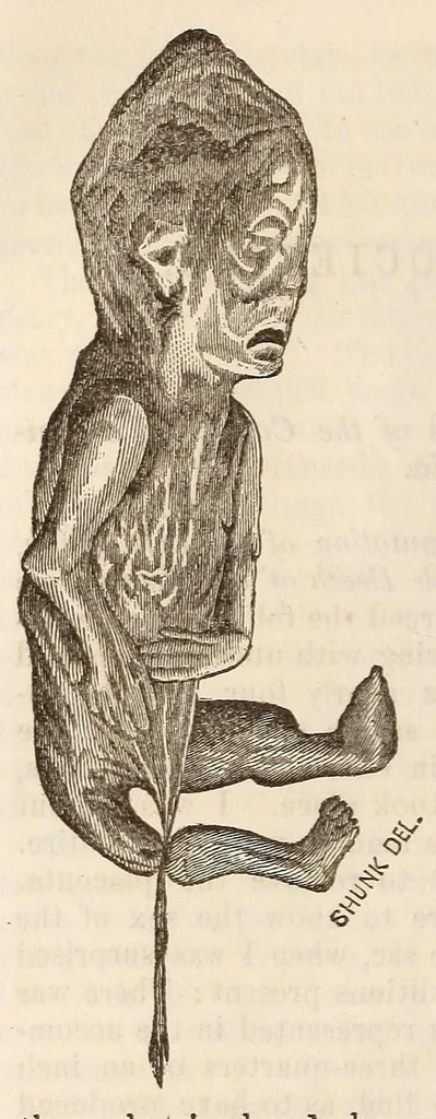 An illustration from The American journal of the medical sciences, 1827, leaf 136