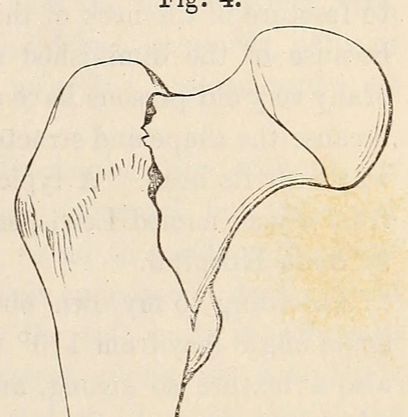 An illustration from The American journal of the medical sciences, 1827, leaf 383