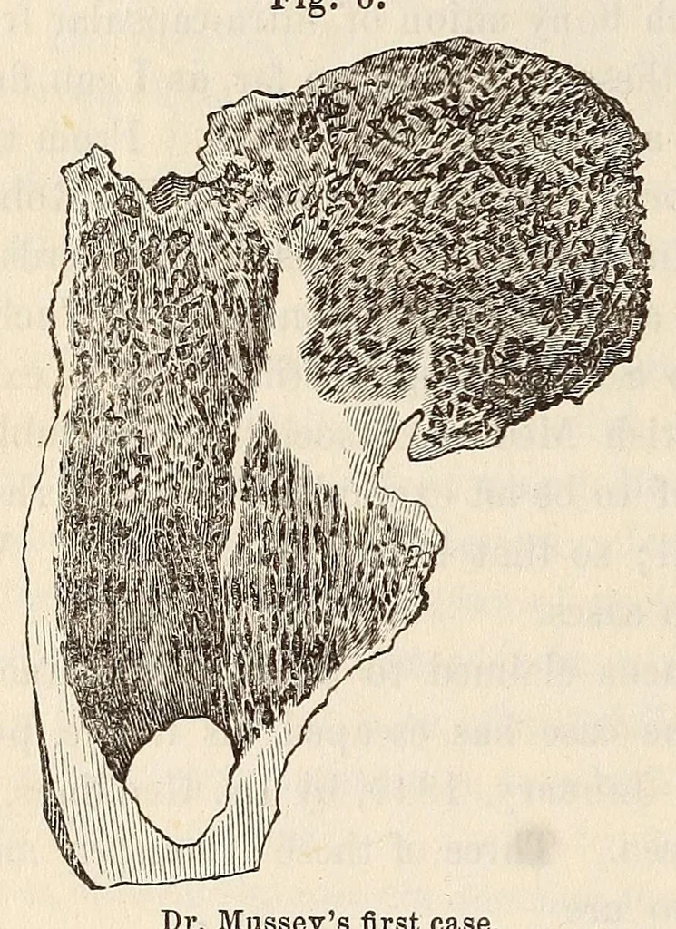 An illustration from The American journal of the medical sciences, 1827, leaf 388